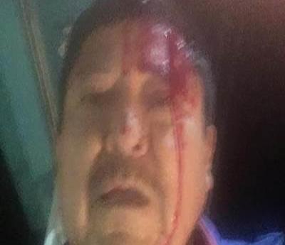 Agreden a batazos al periodista Martín Valtierra (Baja California Sur)